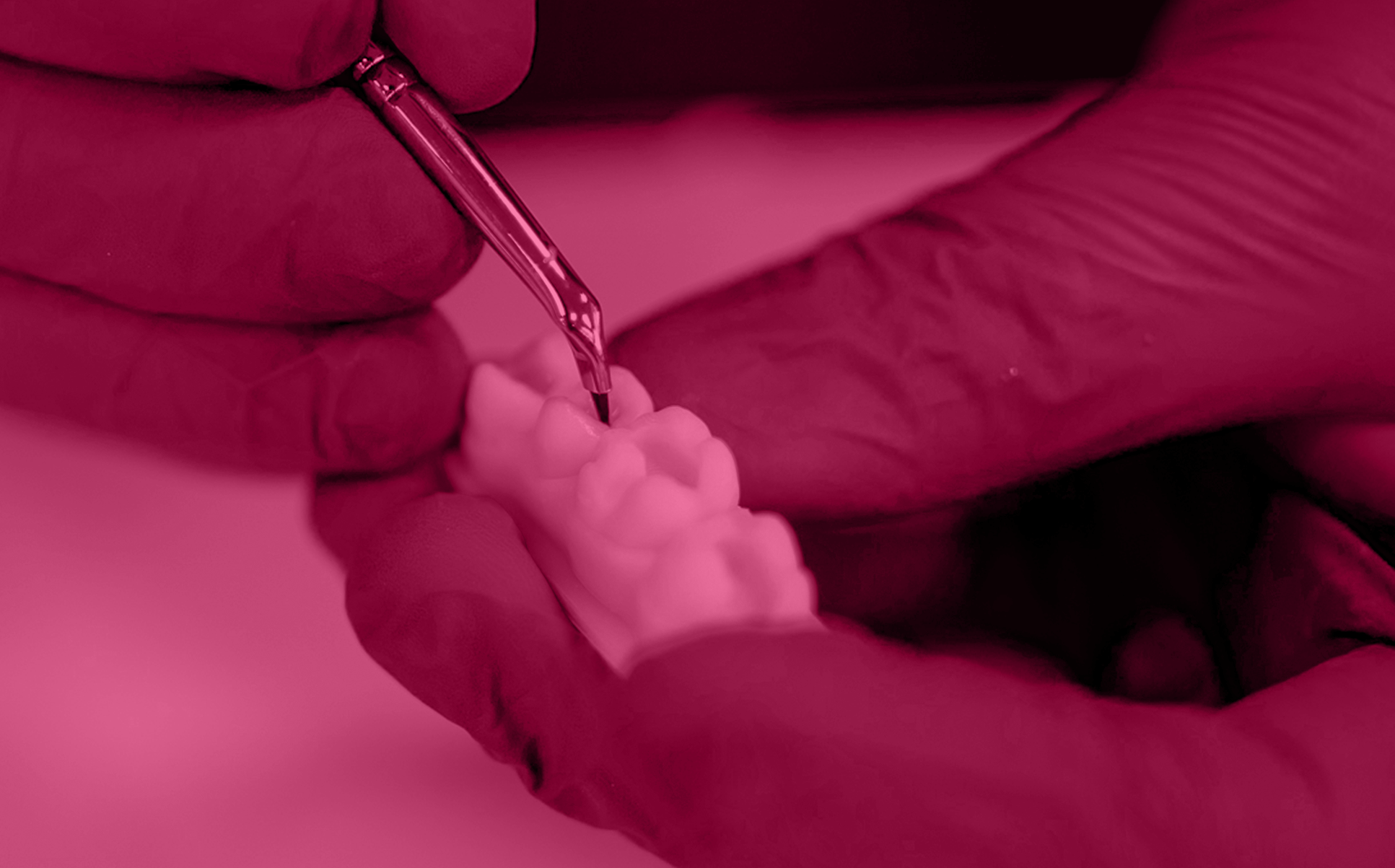 Szkolenie z odbudowy zębów bocznych – stomatologia zachowawcza Szkolenie z odbudowy zębów bocznych – stomatologia zachowawcza