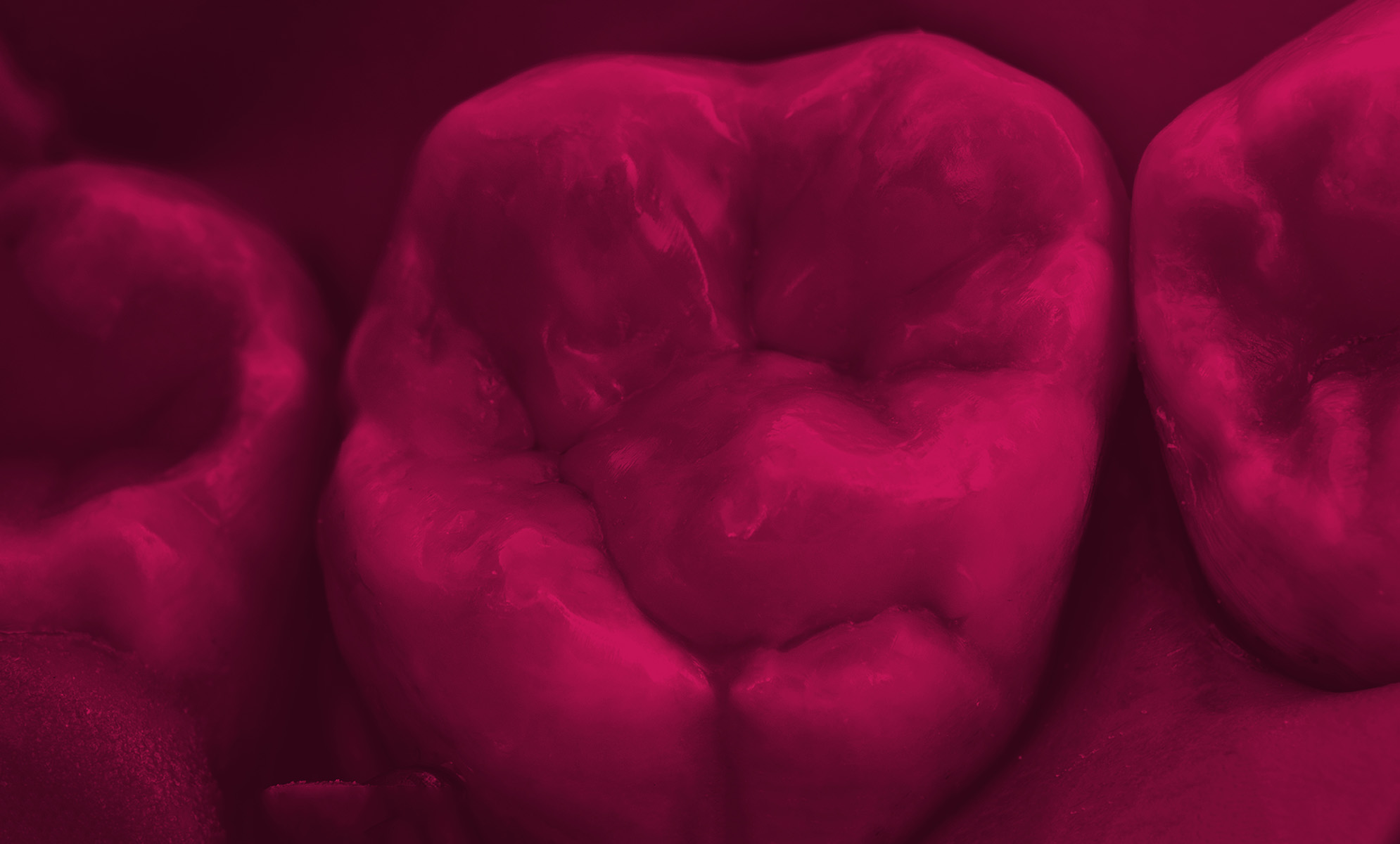 Mistrzowskie odbudowy zębów bocznych | kurs dla dentystów