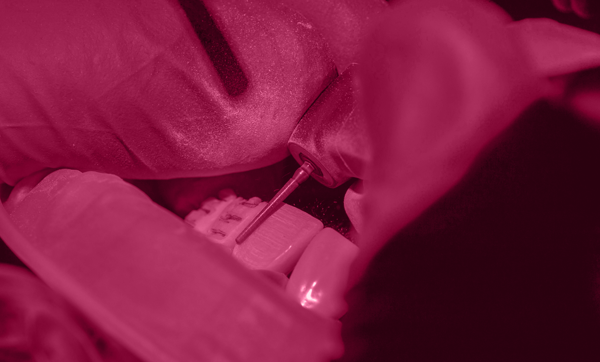 Szkolenia z odbudowy zębów przednich – stomatologia zachowawcza